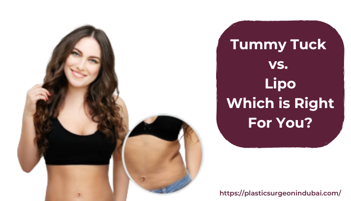 Tummy Tuck vs. Lipo: Which is right for you?