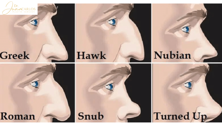 Which Nose Shape Is Most Attractive