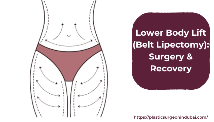 Lower Body Lift (Belt Lipectomy): Surgery & Recovery